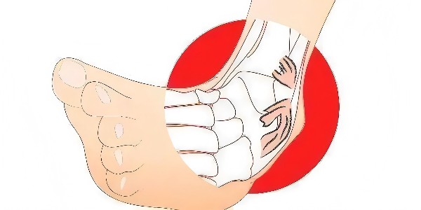 踝關(guān)節(jié)扭傷后的最佳應對指南：簡單四步，助力快速康復！